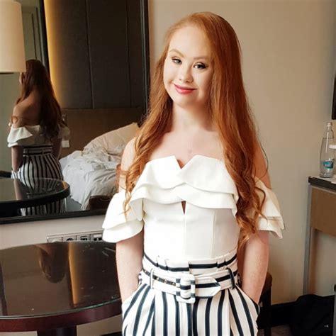 22 years old madeline stuart became the world s first professional catwalk model with down syndrome