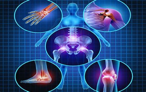 Homeopathic Remedies For Arthritis And Joint Pain