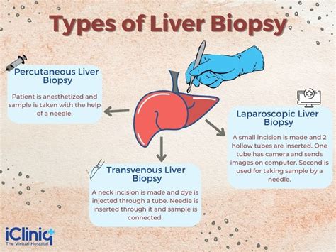 What Is Laparoscopic Liver Biopsy