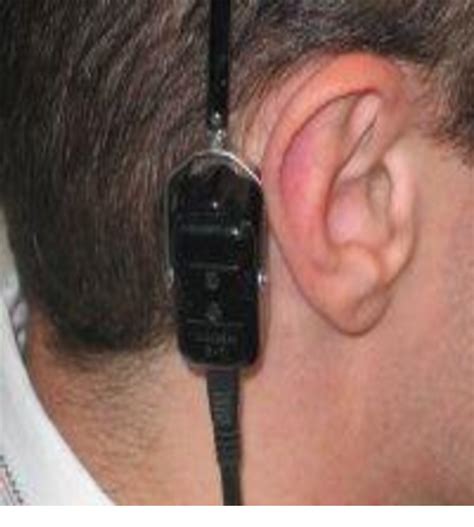 Figure 1 From Guide To Audiology And Hearing Aids For Otolaryngologists