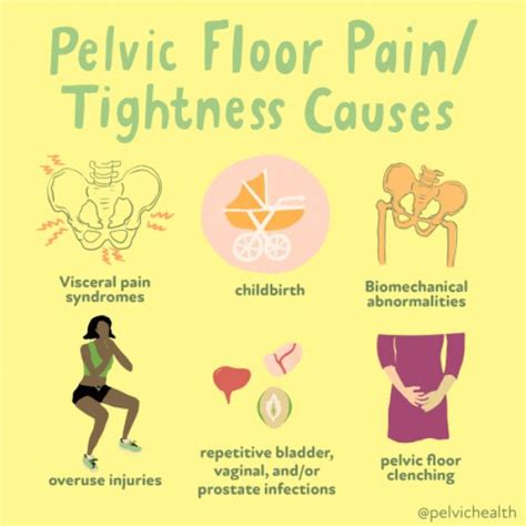 Female Pelvic Pain Physical Therapy In San Francisco Ca Pelvic