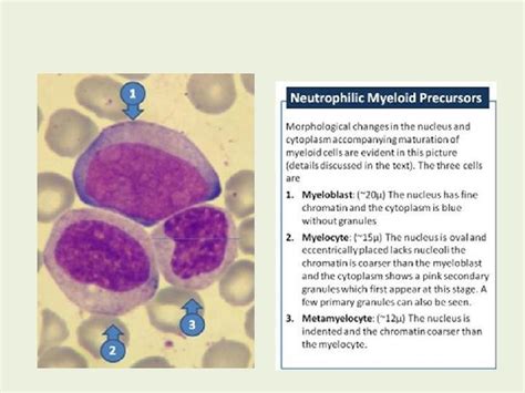 Revision Different Myeloid Stages Charecteristics Of Granulocyte Granules
