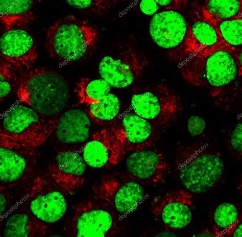 Blood Cells Labeled With Fluorescent Dyes Stock Photo By ©vshivkova