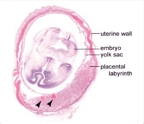 Role Of Tf In The Placenta Cross Section Of Low Tf Embryo And Placenta