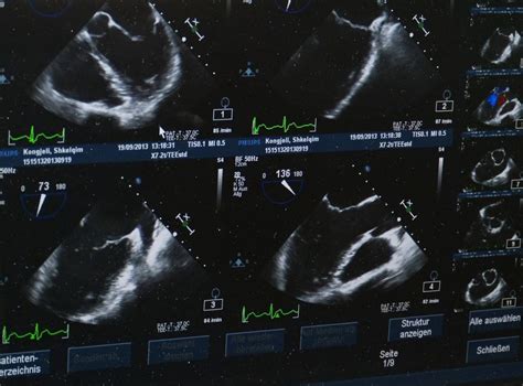 Why Ultrasound Is Making Sound Waves In The World Of Medicine