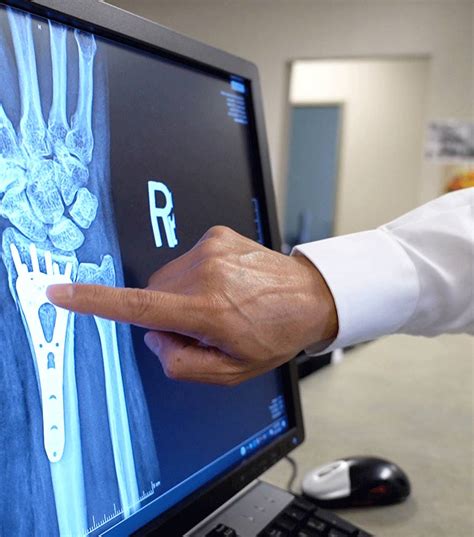 Best Hand And Wrist Surgeons Wichita Mid America Orthopedics