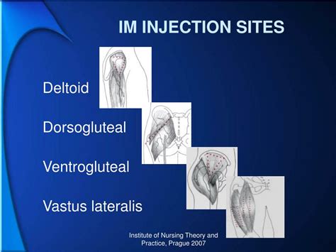 ppt intramuscular injection powerpoint presentation free download id 1295511
