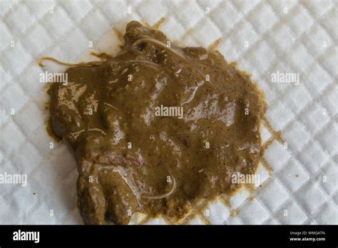 Pinworms In Human Stool