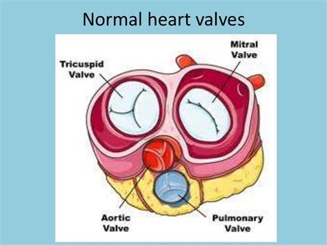 Surgical Treatment Of Valvular Heart Diseases