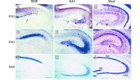 Scip And Ka1 Expression Distinguishes Ca1 And Ca3 In Adult Hippocampus