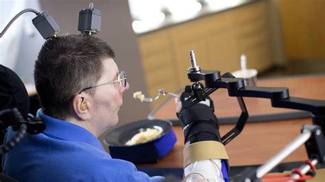 Paralyzed Man Controls His Arm With His Thoughts Shots Health News Npr
