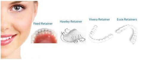 Retainers Orthodontic Center Of Oc