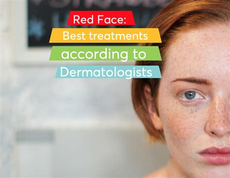 Red Face Causes And Treatments According To Dermatologists Mdacne
