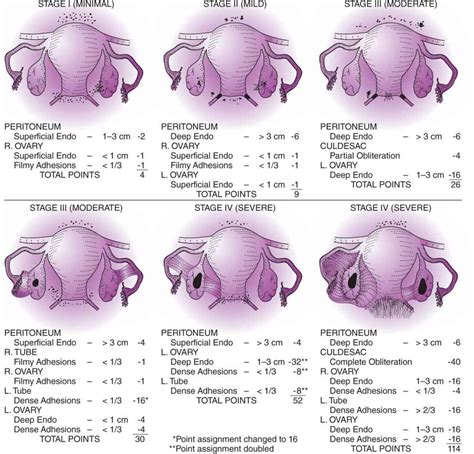 Ballard k.d., seaman h.e., de vries c.s., wright j. Endometriosis - Current Diagnosis & Treatment Obstetrics ...