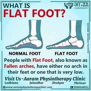Flat Foot Definition Symptoms Causes Rehabilitation Exercises