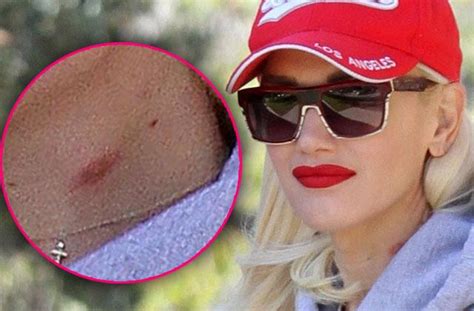 Gwen Stefani Struggles To Hide Her Neck Hickey At The Park