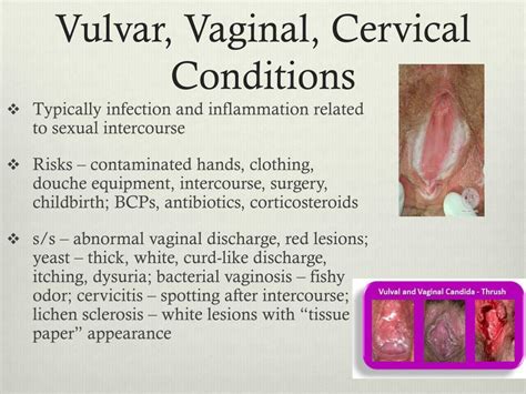 Ppt Female Reproductive Disorders Powerpoint Presentation Free Download Id