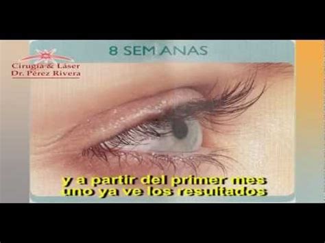 If you are not going to wear removable eyelash extensions and are. Latisse - YouTube