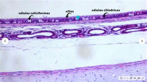 Tecido Epitelial Pseudoestratificado Cilíndrico Ciliado Com Células