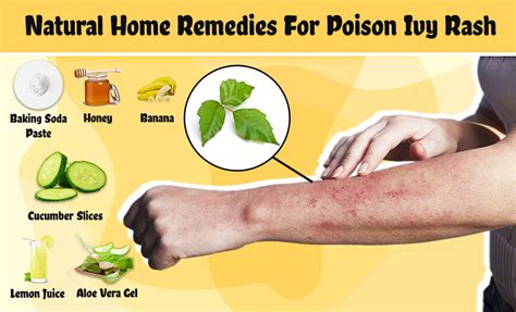 Fast Remedies For Poison Ivy