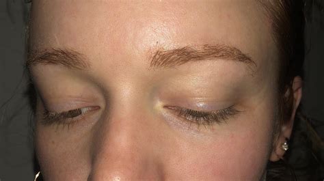How To Fix Bald Spots On Eyebrows Eyebrowshaper