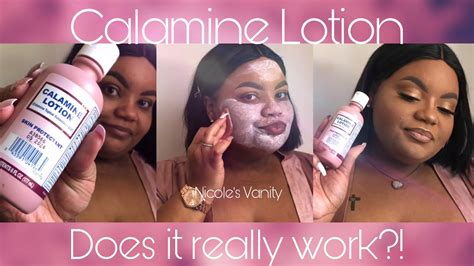 Does Calamine Lotion Really Work Youtube