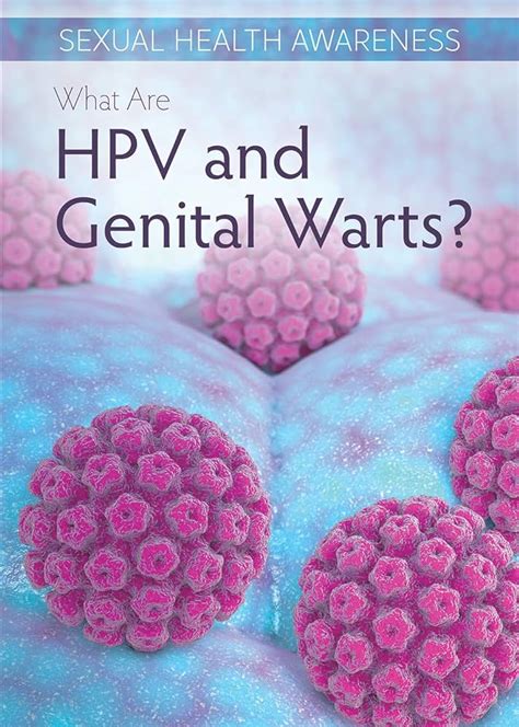 Genital Warts And Sexual Health What You Need To Know Ask The Nurse