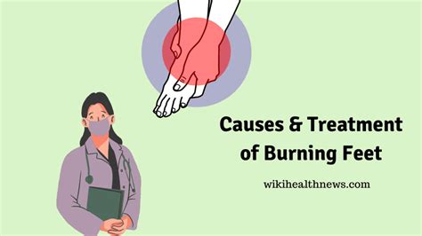 Burning Feet Causes And Treatment Wiki Health News