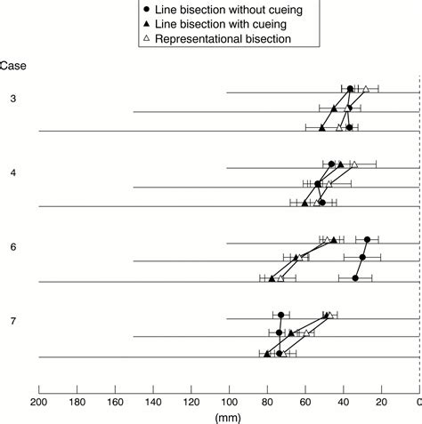This construction shows how to draw the perpendicular bisector of a given line segment with compass and it finds the midpoint of the given line segment. Line versus representational bisections in unilateral spatial neglect | Journal of Neurology ...