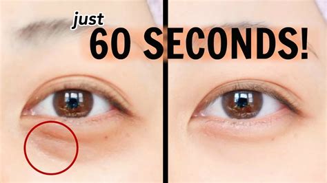 How To Get Rid Of Bags Under Your Eyes Fast Without Makeup Saubhaya