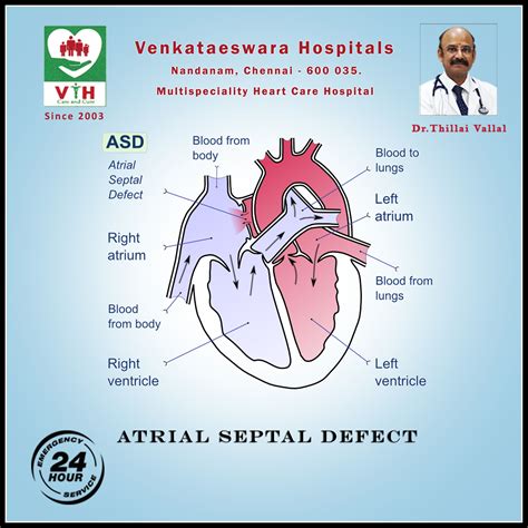 The Atrial Septal Defect Asd Is A Hole In The Wall Between The Two