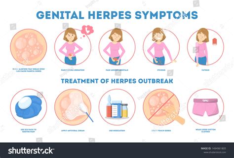 Genital Herpes Symptoms Infectious Dermatology Disease Stock