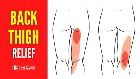 How To Instantly Fix Back Of Thigh Muscle Pain Youtube