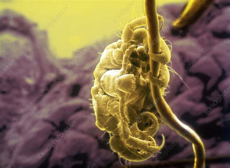 Pubic Louse Sem Stock Image Z Science Photo Library