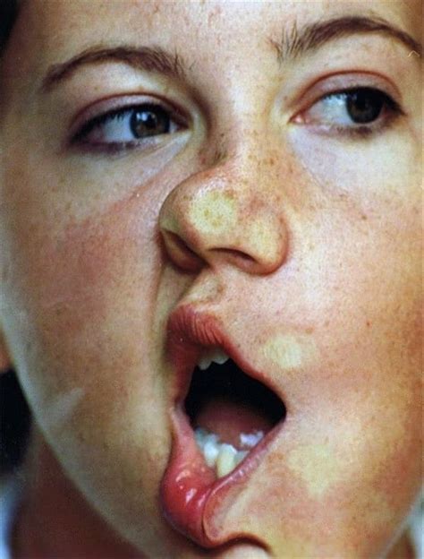 People Squashed Against Glass (9 pics)