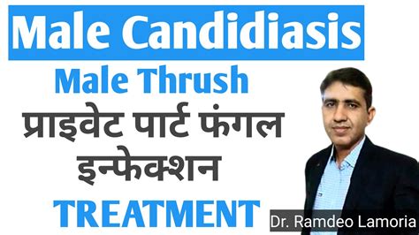 Male Candidiasis Symptomscauses And Treatment Candidiasis Male