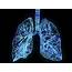Cellular Differences In Asthma Identified First Lung Mapping Project 