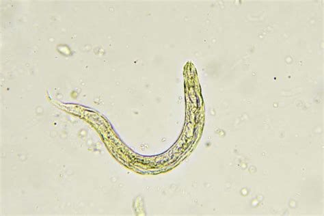 Pinworm Infection What To Know About This Parasite Simplemost