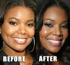The African American Gabrielle Union Had To Undergo A Nose Job For Her Wider Nose Which Really