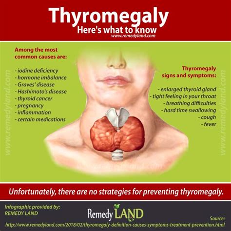 Thyromegaly Definition Causes Symptoms Treatment Prevention