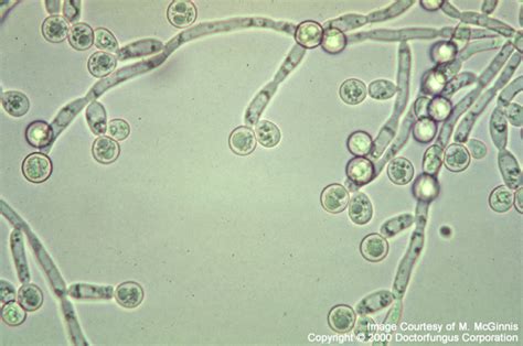 Candida Albicans Doctor Fungus