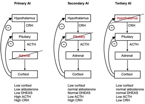 adrenal insufficiency journal of clinical pathology