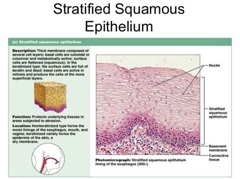 Epithelium Cellstissues And Histology Stratified Squamous Epithelium