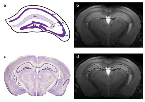 Cellular Layers Organization Of The Mouse Hippocampus A Schematic