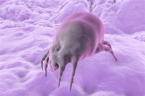 Dust Mite Allergy Here We Show You How To Get Rid Of Them