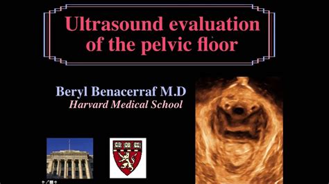 Aium Webinar Ultrasound Evaluation Of The Pelvic Floor Youtube