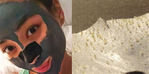 how to get rid of blackheads the right way self