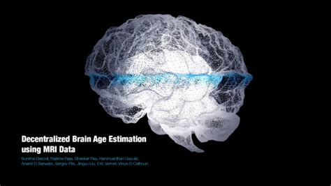 Decentralized Brain Age Estimation Using Mri Data