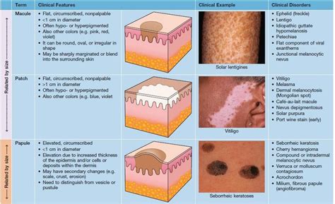 Types Of Skin Lesions Medical Addicts Terms Used To Describe Skin Lesions Dermatology Kulturaupice