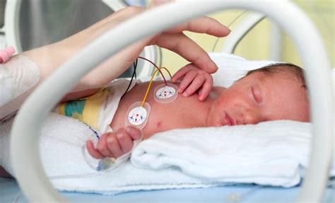 Perawatan Bayi Prematur Smartmama
